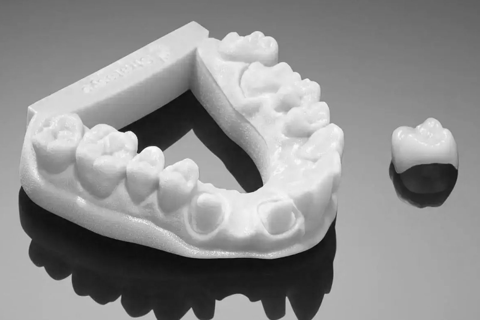 Impresoras 3D en odontología: de la planificación al implante