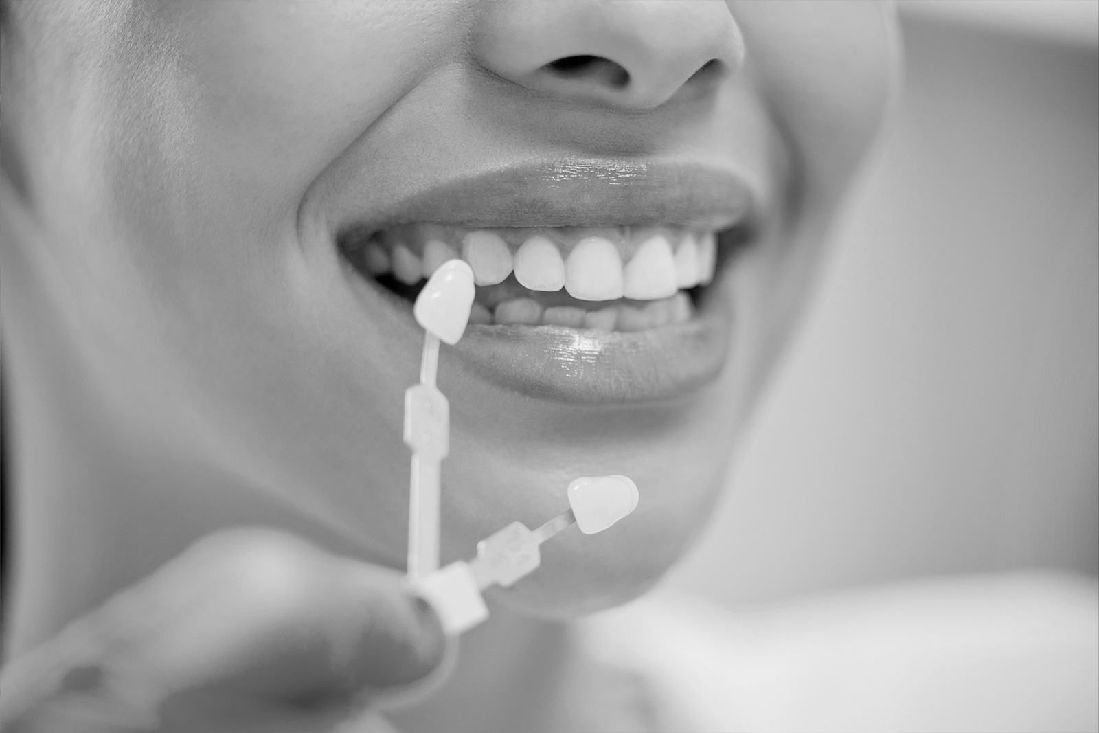 ¿Las carillas desgastan los dientes?
